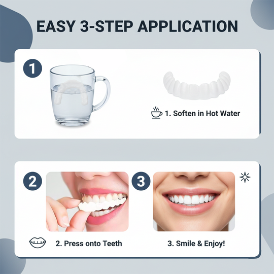 Dental Veneer Kit with Upper and Lower Coverage