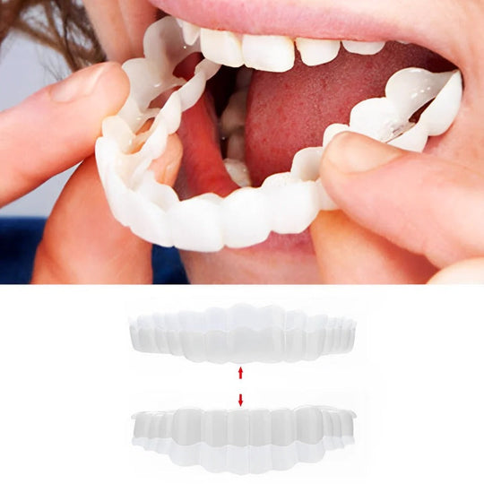 Dental Veneer Kit with Upper and Lower Covers
