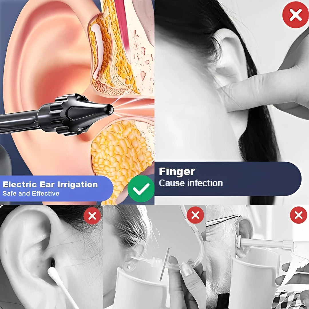 Ear Cleaning Device with Water-Based Rinsing and USB Rechargeable Battery