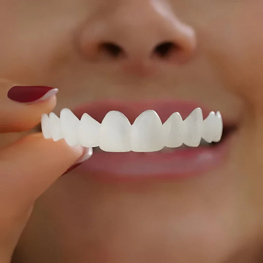 Cosmetic Veneers with Clip-On Design and Temporary Covers