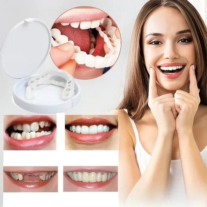 Cosmetic Veneers with Clip-On Design and Temporary Covers