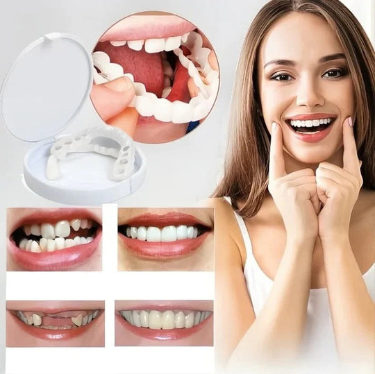 Cosmetic Veneers with Clip-On Design and Temporary Covers