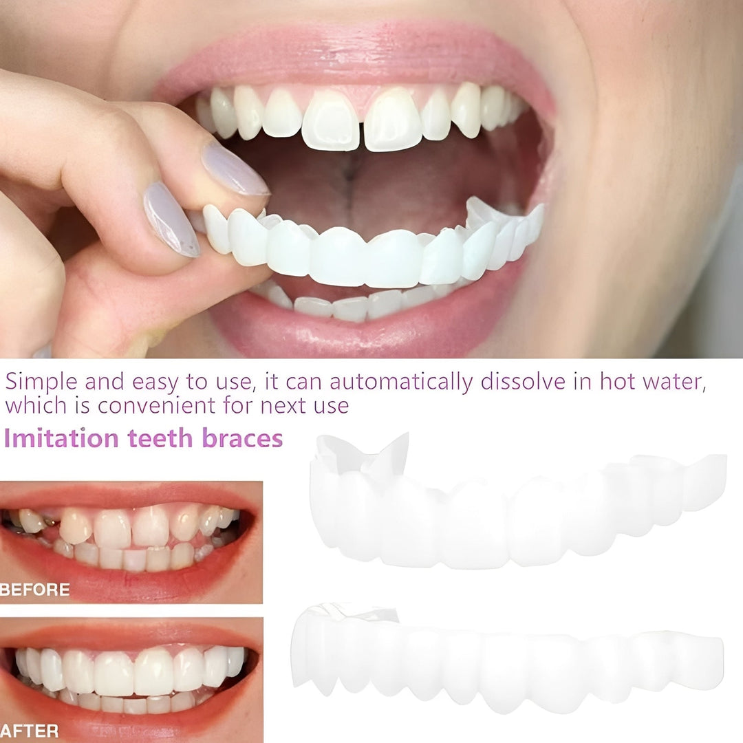 Cosmetic Tooth Covers with Snap-On Design and 2-Piece Set