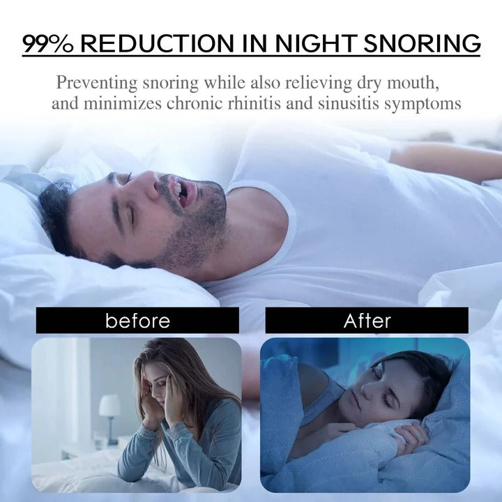 Mouth Tape with Nasal Breathing Support and Sleep Aid