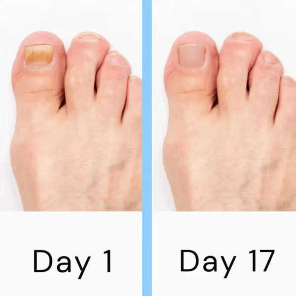 Nail Care Device with Portable Design and Rechargeable Battery