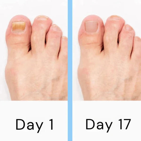 Nail Care Device with Portable Design and Rechargeable Battery