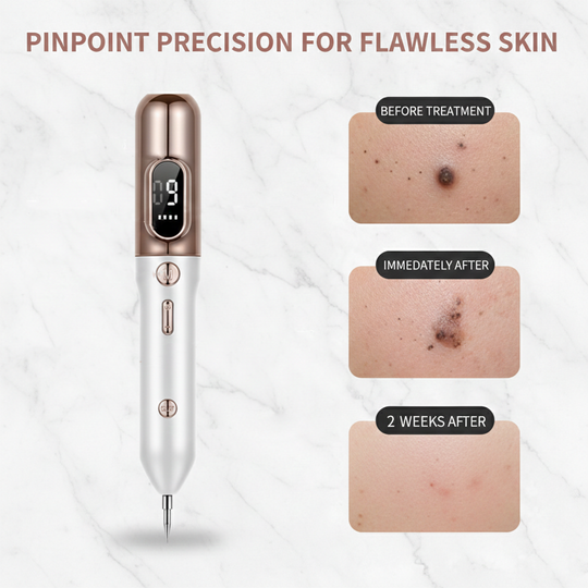 Plasma Pen with Adjustable Levels and Handheld Design