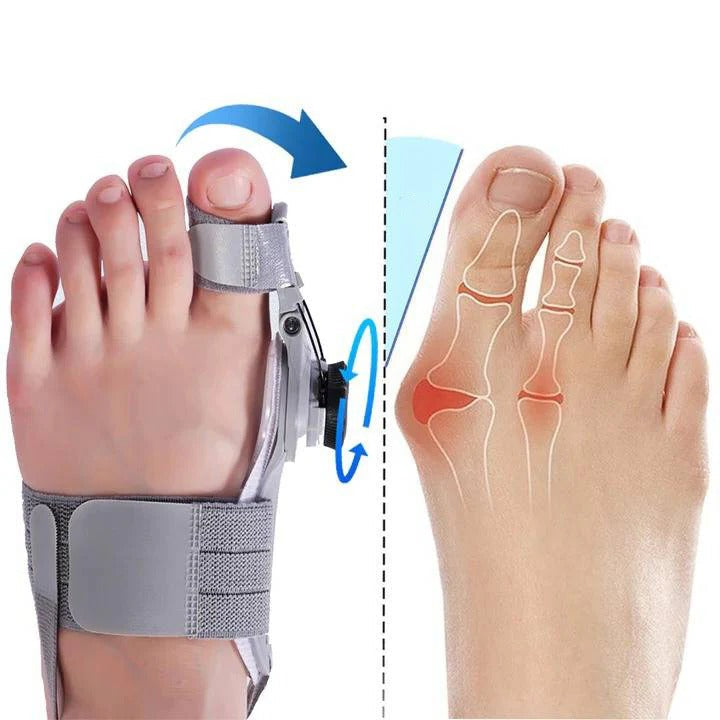 Toe Spacer with Adjustable Fit and Foot Alignment