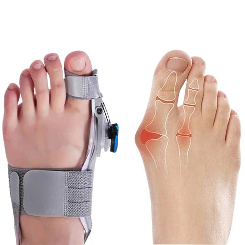 Toe Spacer with Adjustable Fit and Foot Alignment