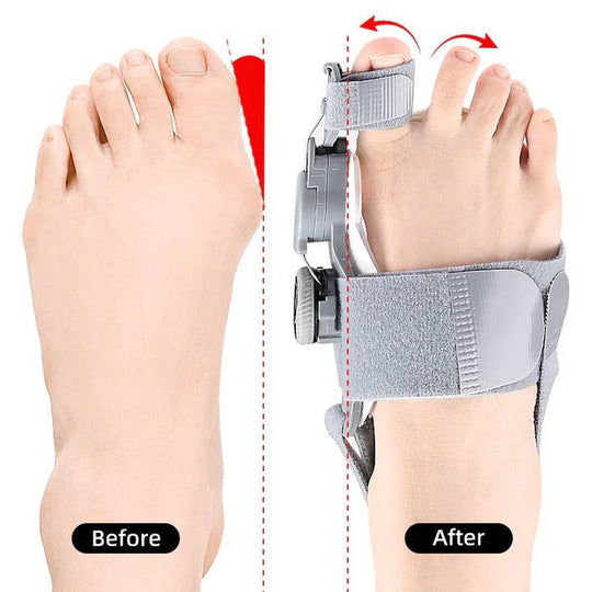Toe Spacer with Adjustable Fit and Foot Alignment